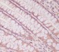Anti-Smad1 Rabbit Monoclonal Antibody